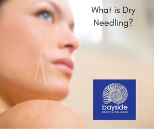 dry-needling