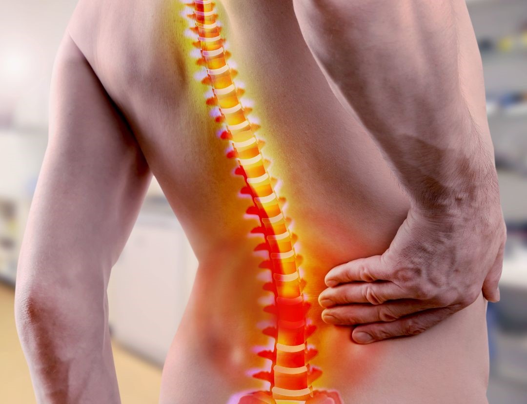 Understanding Lumbar Spine Nerve Impingement: Causes and Effective Management